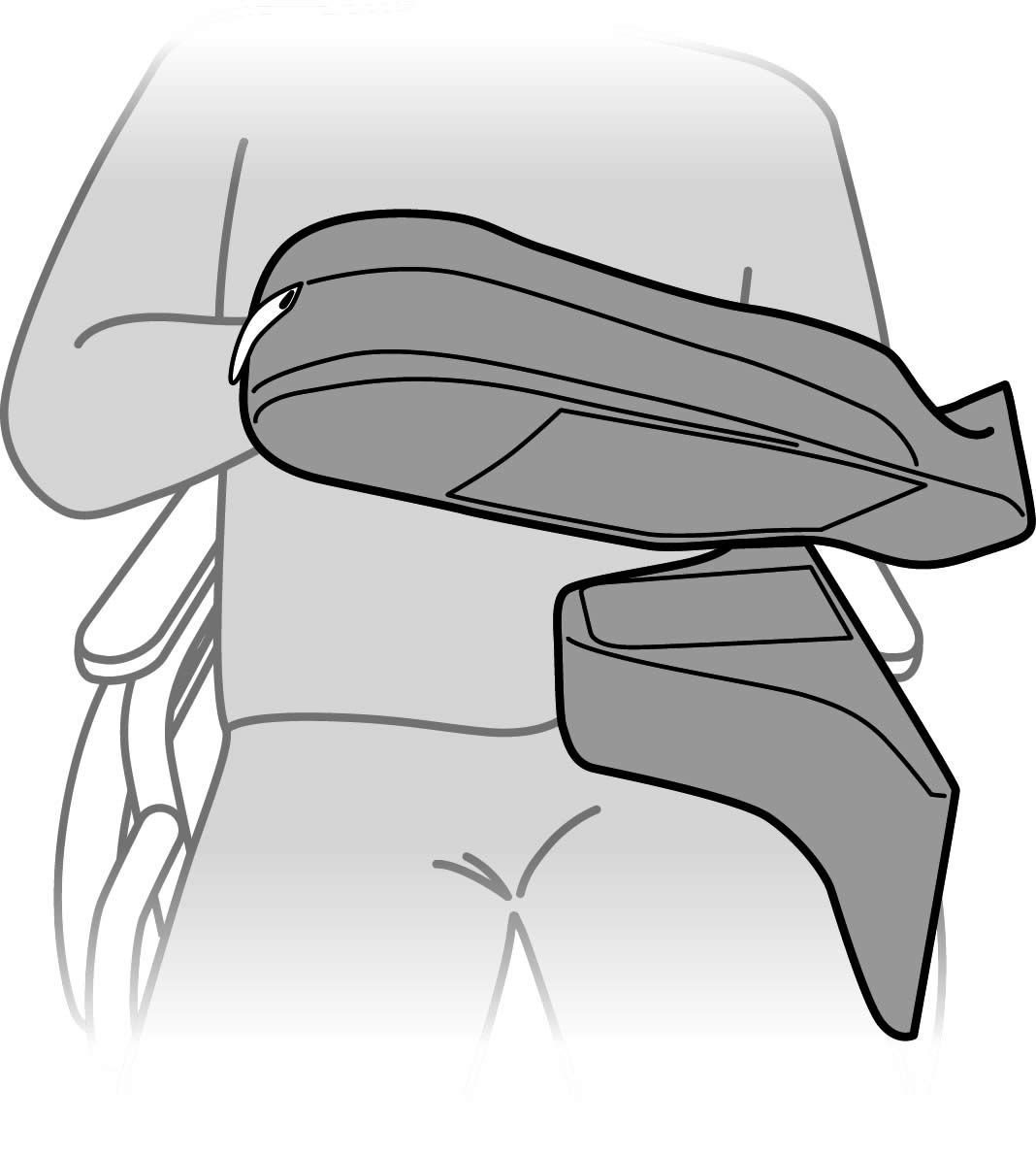 System upper limb positioning wedge block groove and zone