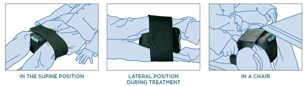 Systam Abduction Wedge For Preventing Hip Dislocation After Surgery