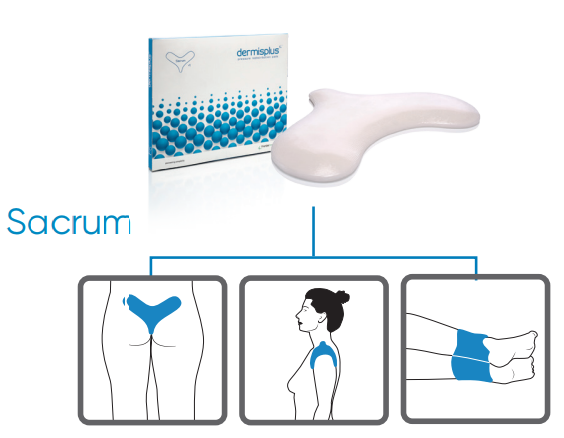 The DermisPlus Sacrum Pad can be used to relieve a number of areas Sacrum Pad in Use