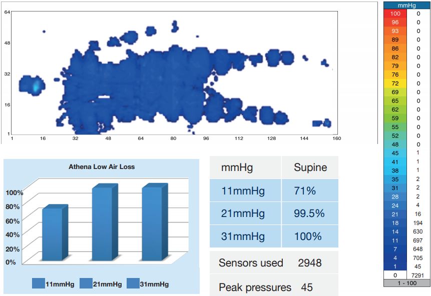 Pressure mapping of the Athena Low Airloss Pressure Relief Mattress