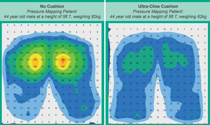 Pressure mapping of the ultra-cline cushion